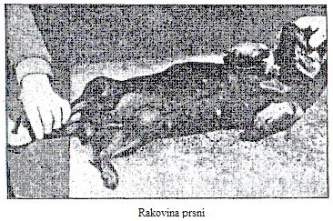 Rakovina prsn�