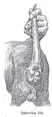 Rakovina �iti